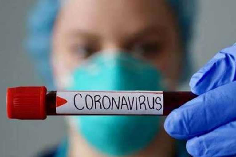 8985 new cases of corona infection in Russia