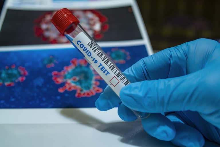 3,607 new coronavirus cases in Maharashtra, 152 deaths