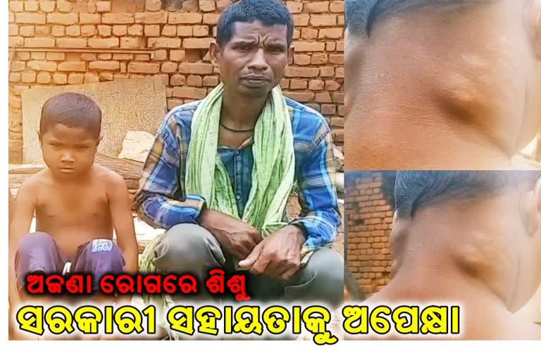 children-with-unknown-diseases-family-need-govt-help-in-nuapada