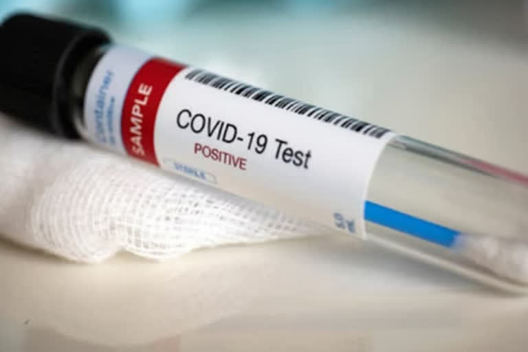 icmr on  Antigen testing kit for covid