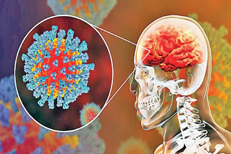 Coronavirus may infect respiratory centre of brain, suggests research