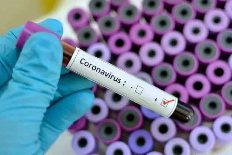 mandi resident died due to coronavirus