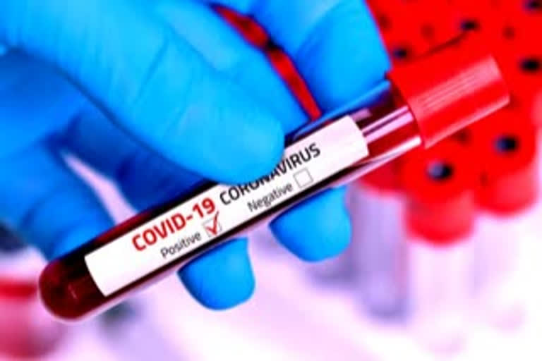 ITBP reports 8 fresh COVID-19 cases tally rises to 70 in ITBP Force total cases raised to 221 in ITBP Coronavirus positive cases in ITBP இந்திய திபெத் எல்லை பாதுகாப்பு படை கரோனா பாதிப்பு