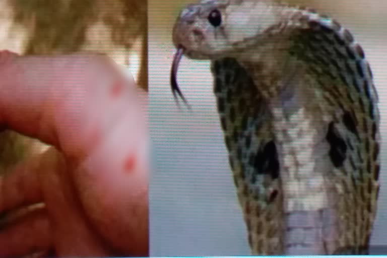 snake-catcher-dies-of-snakebite