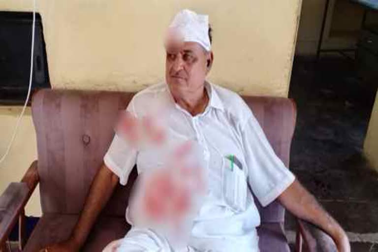 अतिक्रमियों ने किया हमला, Trespassers attacked