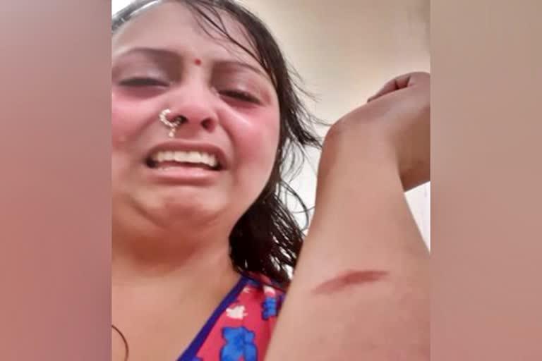 domestic violence victim is helpless in dubai