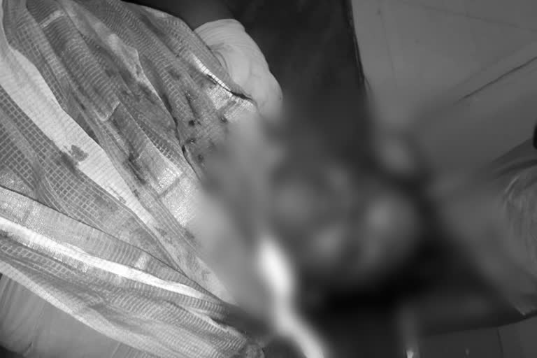 son in law attack on mother in law with knife at kurnool district