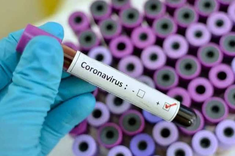 Coronavirus