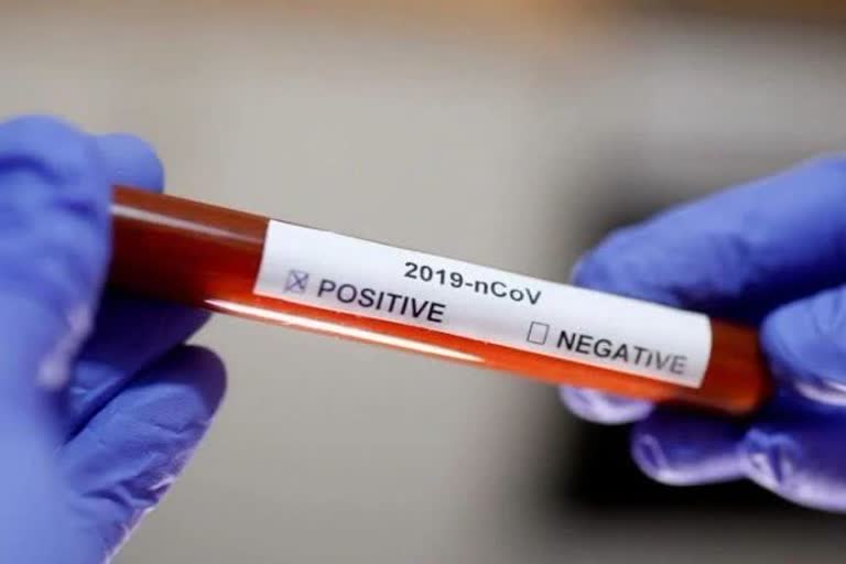 32-corona-virus-positive-patients-found-in-balod