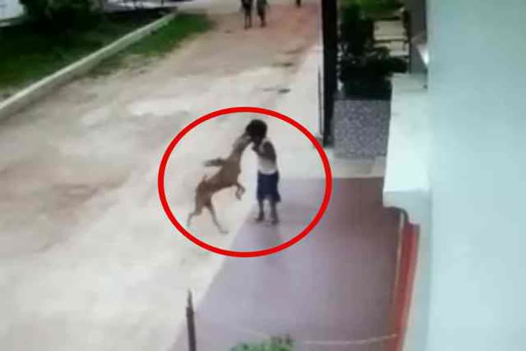 Dog attacked on 5 year old child