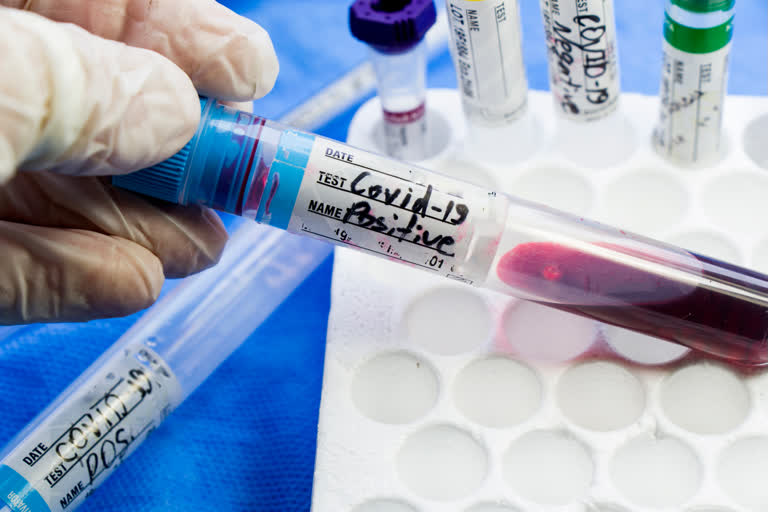 PCR test, Antibody test, Corona Virus