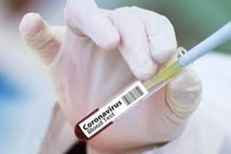 160 new covid positive cases reported in kottayam district  കോട്ടയം ജില്ലയില്‍ 160 പേര്‍ക്ക് കൂടി കൊവിഡ്  covid positive cases reported in kottayam district  covid updates  kottayam news  കൊവിഡ് കോട്ടയം