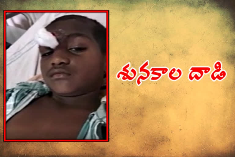 వీధి కుక్కల స్వైర విహారం... ముగ్గురు చిన్నారులకు గాయాలు