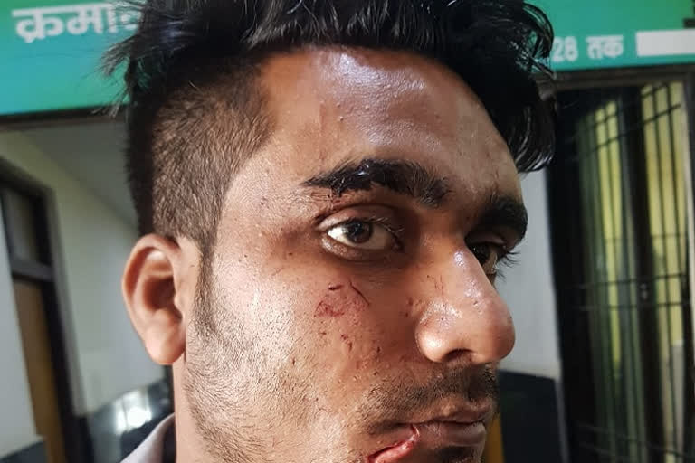 supervisor beaten by constable in kabir nagar raipur