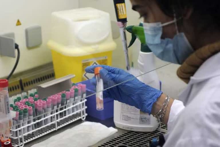 Reliance develops RT-PCR kit that can give COVID-19 results in 2hrs