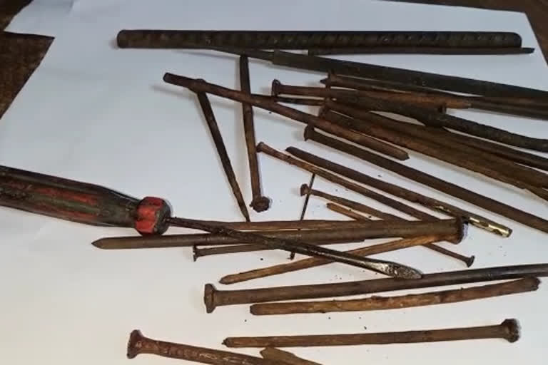 Doctors took out 35 iron nails