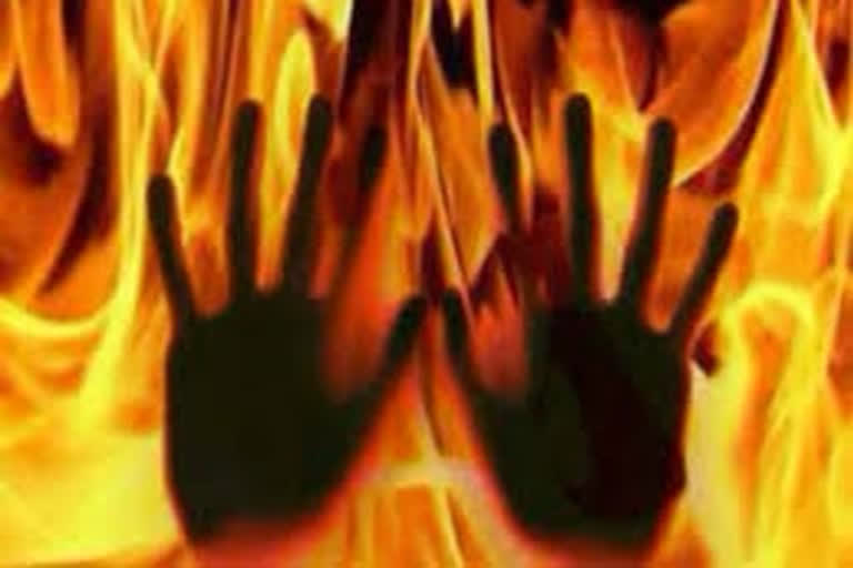 Minor girl set on fire by owner's son when she resisting rape attempt