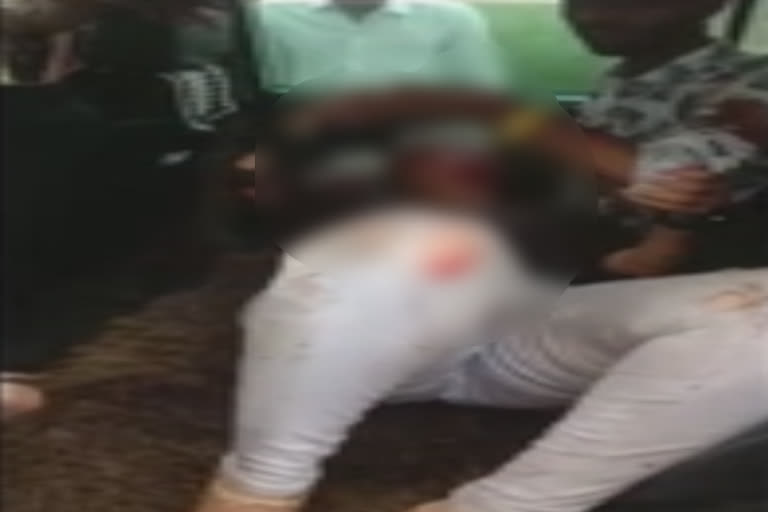 couple-injured-in-attack-by-womans-father-in-karnataka