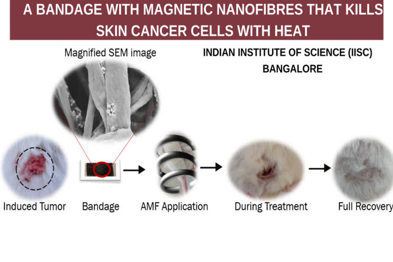 skin cancer cells , magnetic nanofibres