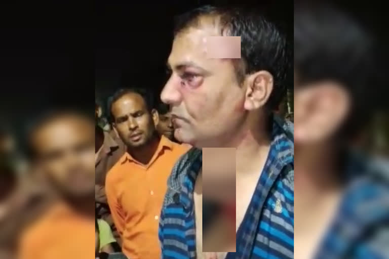 Video viral by shopkeepers beating faridabad policeman and case filed