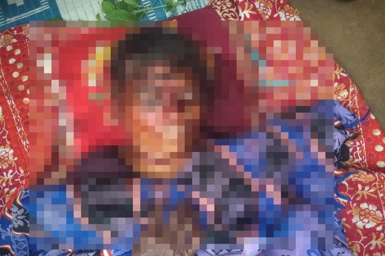 woman-killed-in-leopard-attack-in-thakurnagar-in-gadchiroli-district