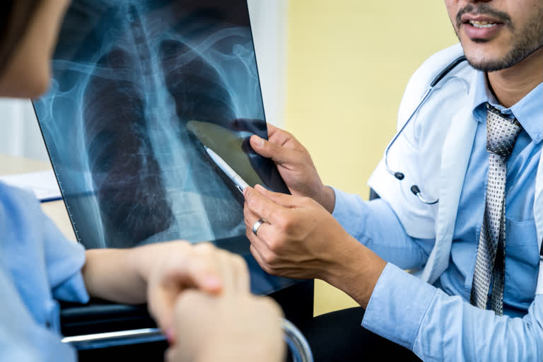 Lungs, Lungs during COVID, Patients and COVID