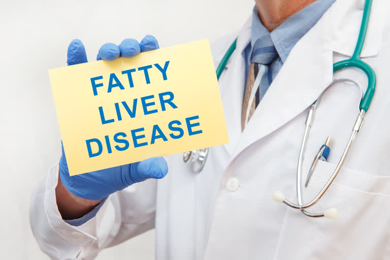 Fatty liver, Treating fatty liver, Supplement for fatty liver