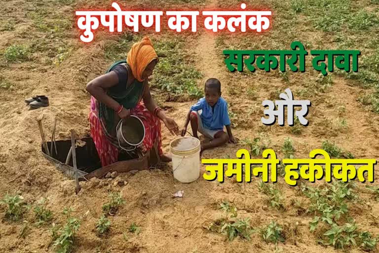 malnutrition free Chhattisgarh