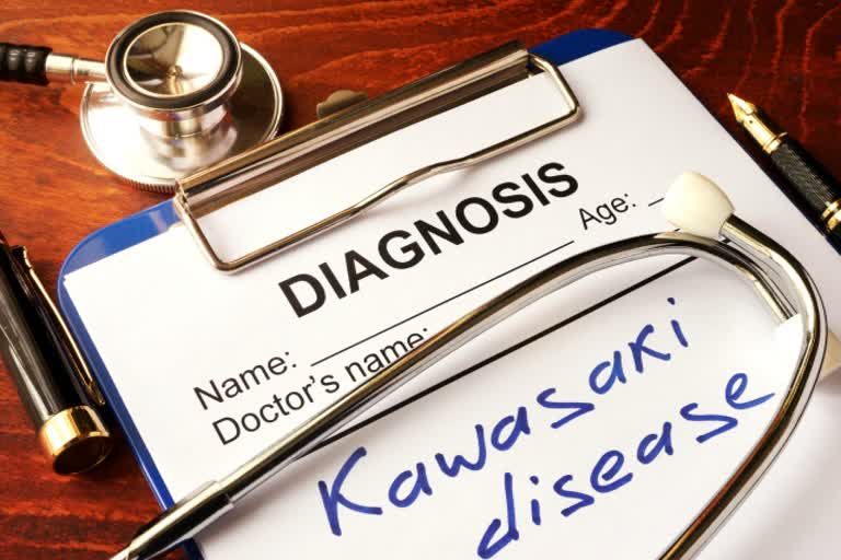 Kawasaki disease, Kids and kawasaki disease, Cardiac issues in kid