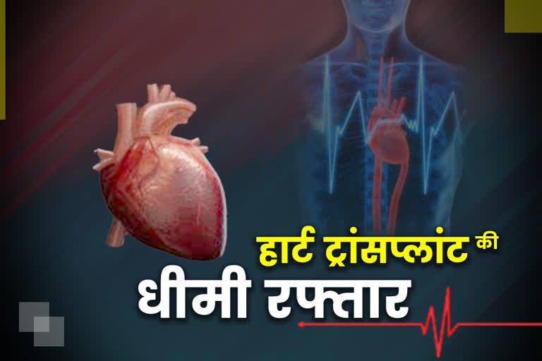 organ transplant, अंग प्रत्यारोपण