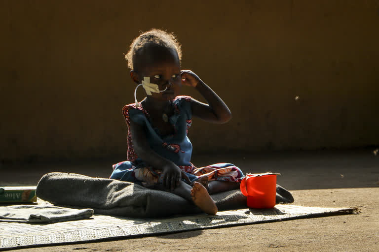 Hunger study predicts 168,000 pandemic-linked child deaths