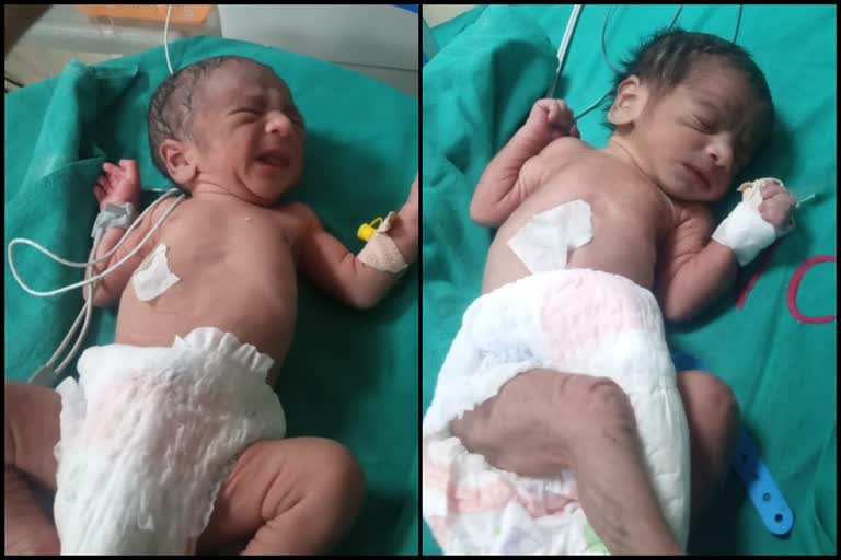 twins normal delivery haryana sonipat