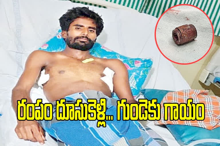 క్లిష్టమైన శస్త్రచికిత్సలో గుంటూరు జీజీహెచ్ వైద్యుల సత్తా