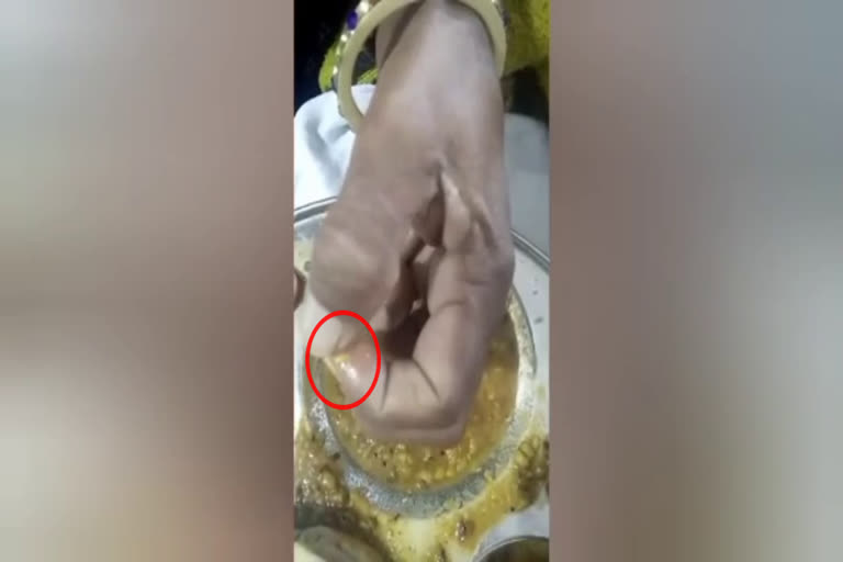 worm in the patient food