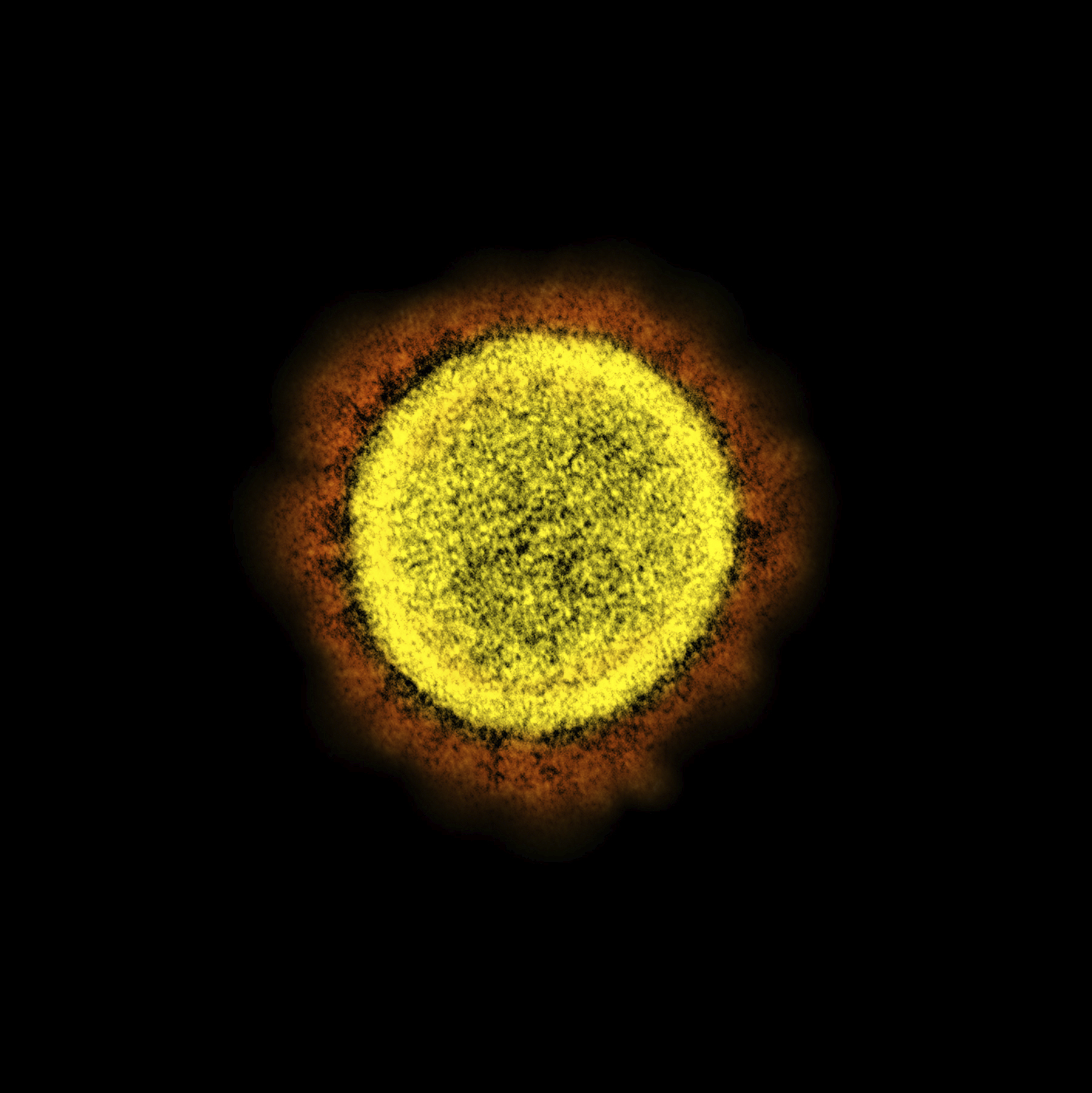 A Novel Coronavirus SARS-CoV-2 particle isolated from a patient, in a laboratory in Fort Detrick, US.