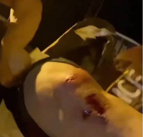 Bigg Boss 13 contestant showing injuries on his knees