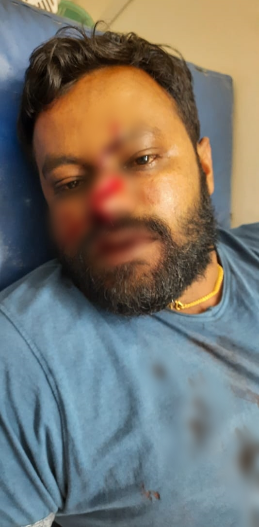 Bikers attack on man, Bikers attack on man in Bangalore, bike wheelie, bike wheelie news, ಬೈಕ್​ ವೀಲರ್ಸ್​ನಿಂದ ಹಲ್ಲೆ, ವ್ಯಕ್ತಿ ಮೇಲೆ ಬೈಕ್​ ವೀಲರ್ಸ್​ನಿಂದ ಹಲ್ಲೆ, ಬೆಂಗಳೂರಿನಲ್ಲಿ ವ್ಯಕ್ತಿ ಮೇಲೆ ಬೈಕ್​ ವೀಲರ್ಸ್​ನಿಂದ ಹಲ್ಲೆ, ಬೈಕ್​ ವೀಲಿಂಗ್​, ಬೈಕ್​ ವೀಲಿಂಗ್​ ಸುದ್ದಿ,