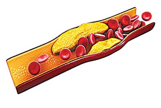 INFLAMMATORY PROCESS