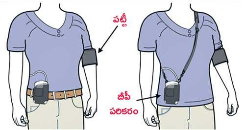 High blood pressure problem in Children