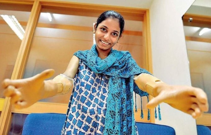 Monica More discharged after successful hand transplant surgery