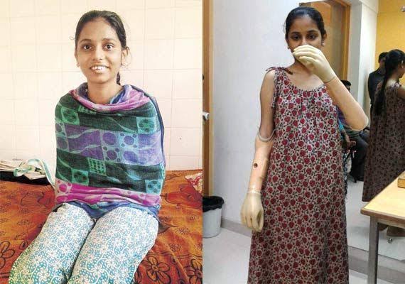 Monica More discharged after successful hand transplant surgery