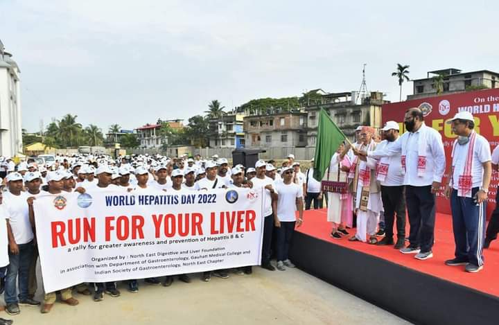 Health Minister Keshav Mahanta in the race for World Hepatitis Day