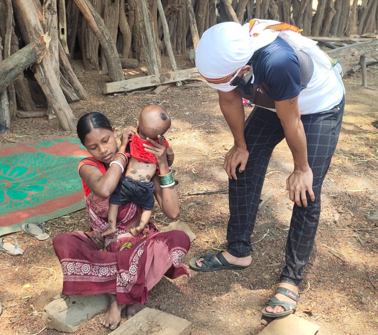 black-spots-on-the-body-of-a-two-and-a-half-month-old-girl-in-jholarao-vanagram-of-gariaband-district