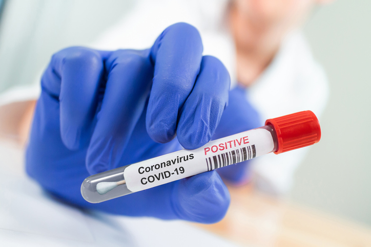 four patients died of coronavirus in gorakhpur uttar pradesh