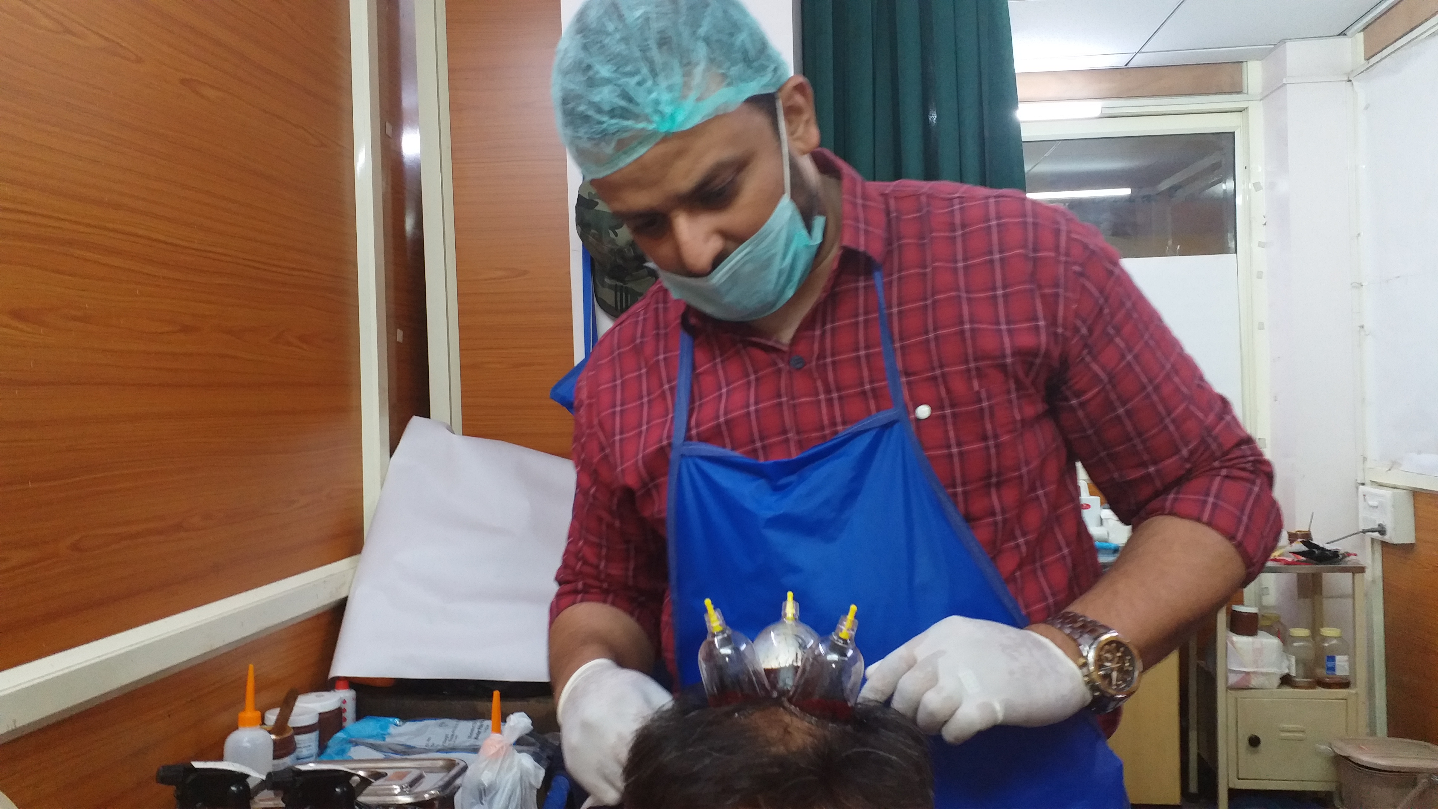 hair treatment through hijama