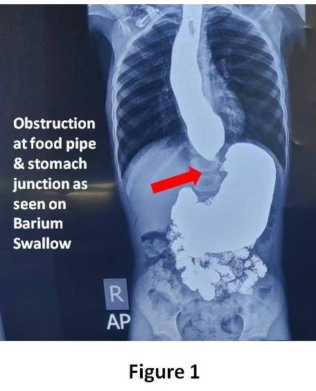 Special Endoscopic Procedures