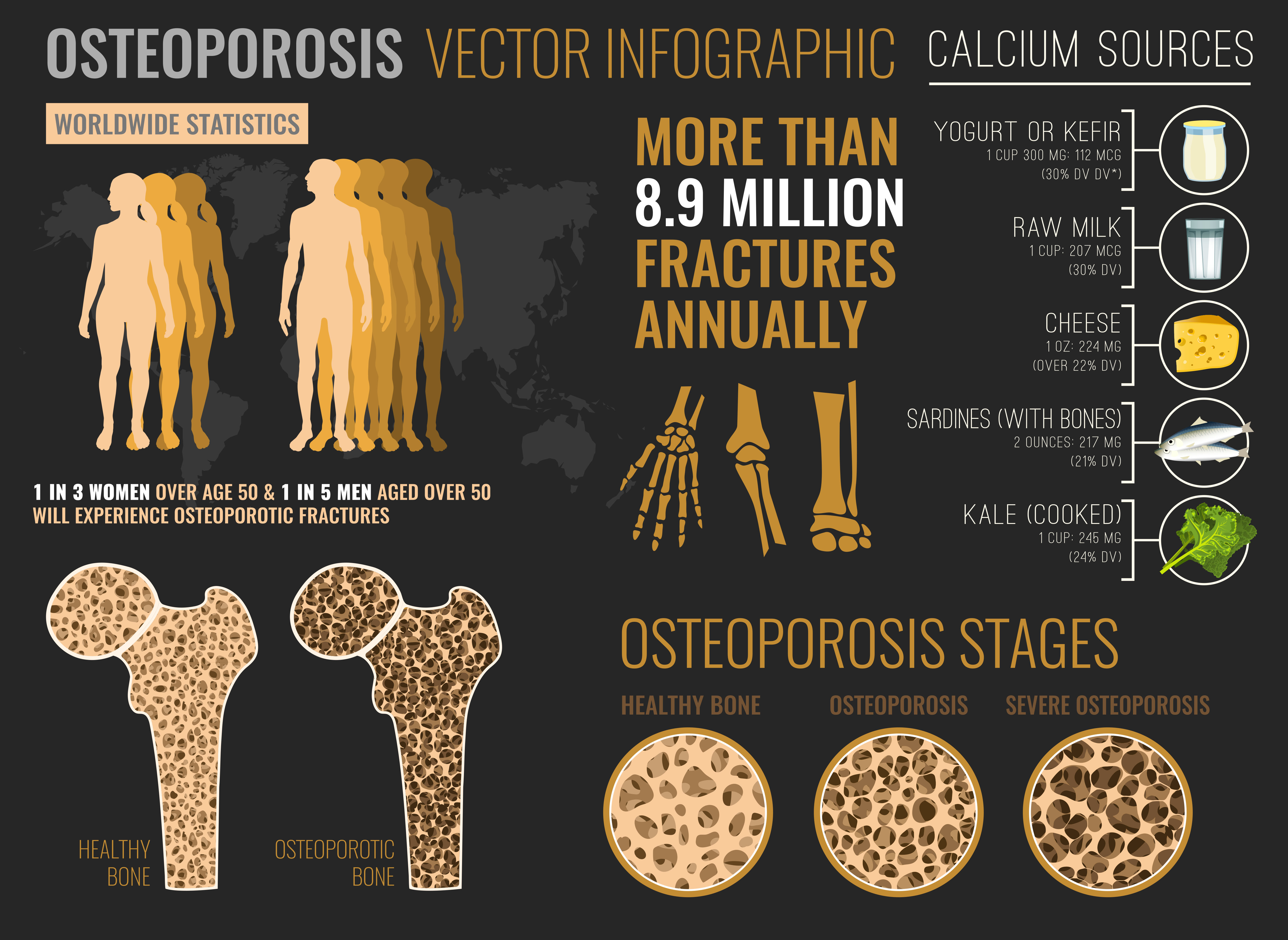 Osteoporosis