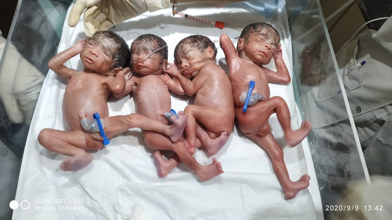 a mother gave birth to 4 children at once in dahod, gujarat