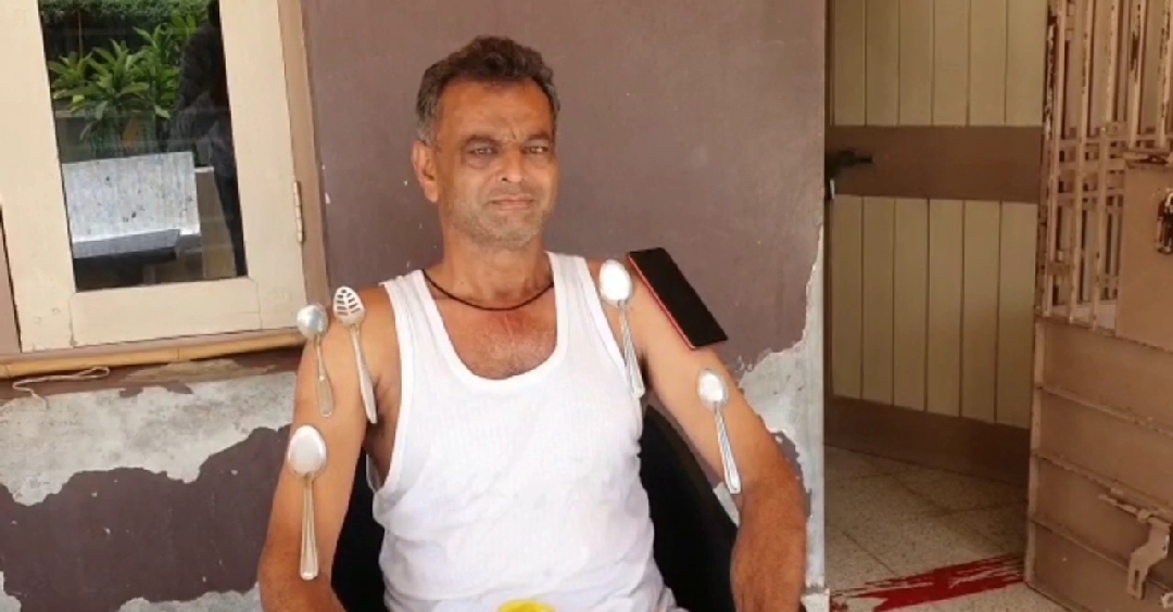 Magnet man in Gujarat: નડિયાદમાં પૂર્વ કાઉન્સિલરના શરીરમાં ચુંબકીય અસરની ઘટના