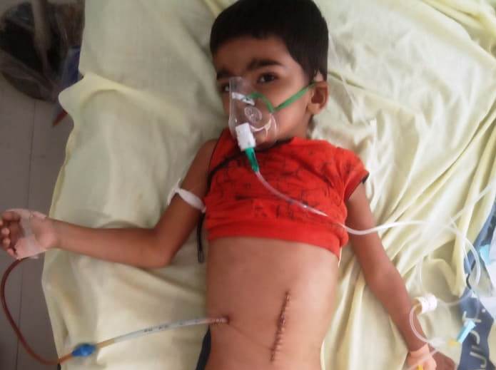 રાજકોટની સિવિલ હોસ્પિટલમાં 4 વર્ષના કોરોના પોઝિટિવ બાળકનું આંતરડાનું ઓપરેશન કર્યા બાદ મળ્યુ નવજીવન